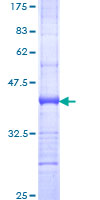 ab158990 on a 12.5% SDS-PAGE stained with Coomassie Blue.