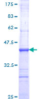 ab158992 on a 12.5% SDS-PAGE stained with Coomassie Blue.