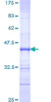 ab158993 on a 12.5% SDS-PAGE stained with Coomassie Blue.