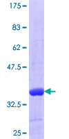 ab160315 on a 12.5% SDS-PAGE stained with Coomassie Blue.