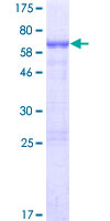 ab166359 on a 12.5% SDS-PAGE stained with Coomassie Blue.