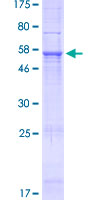ab166407 on a 12.5% SDS-PAGE stained with Coomassie Blue.