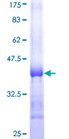 ab153224 on a 12.5% SDS-PAGE stained with Coomassie Blue.
