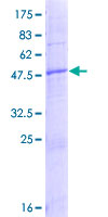 ab164550 on a 12.5% SDS-PAGE stained with Coomassie Blue.