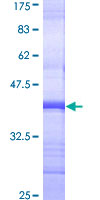 ab158116 on a 12.5% SDS-PAGE stained with Coomassie Blue.
