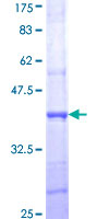 ab152279 on a 12.5% SDS-PAGE stained with Coomassie Blue.
