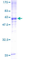 ab114193 on 12.5% SDS-PAGE stained with Coomassie Blue.