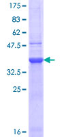ab152280 on a 12.5% SDS-PAGE stained with Coomassie Blue.