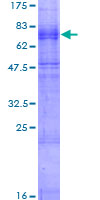 ab158118 on a 12.5% SDS-PAGE stained with Coomassie Blue.