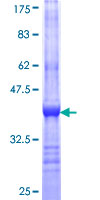 ab158119 on a 12.5% SDS-PAGE stained with Coomassie Blue.