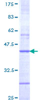 ab158120 on a 12.5% SDS-PAGE stained with Coomassie Blue.