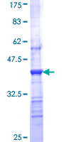 ab158117 on a 12.5% SDS-PAGE stained with Coomassie Blue.