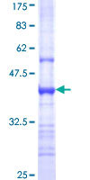 12.5% SDS-PAGE Stained with Coomassie Blue