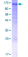 ab153185 on a 12.5% SDS-PAGE stained with Coomassie Blue.