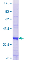 ab153186 on a 12.5% SDS-PAGE stained with Coomassie Blue.