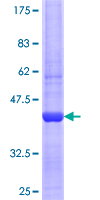 ab153100 on a 12.5% SDS-PAGE stained with Coomassie Blue.