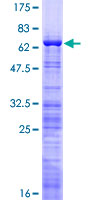 ab164582 on a 12.5% SDS-PAGE stained with Coomassie Blue.