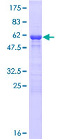 ab164180 on a 12.5% SDS-PAGE stained with Coomassie Blue.