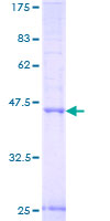 ab163519 on a 12.5% SDS-PAGE stained with Coomassie Blue.