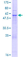 ab160063 on a 12.5% SDS-PAGE stained with Coomassie Blue.