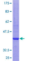ab160064 on a 12.5% SDS-PAGE stained with Coomassie Blue.