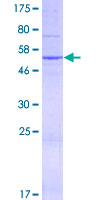 ab161838 on a 12.5% SDS-PAGE stained with Coomassie Blue.