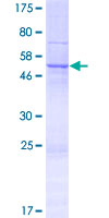 ab163069 on a 12.5% SDS-PAGE stained with Coomassie Blue.
