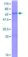 ab159000 on a 12.5% SDS-PAGE stained with Coomassie Blue.