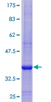 ab159001 on a 12.5% SDS-PAGE stained with Coomassie Blue.