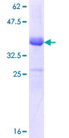 ab159532 on a 12.5% SDS-PAGE stained with Coomassie Blue.