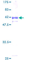 ab164753 on a 12.5% SDS-PAGE stained with Coomassie Blue.