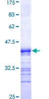 ab164128 on a 12.5% SDS-PAGE stained with Coomassie Blue.