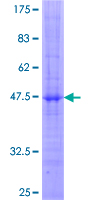 ab158798 on a 12.5% SDS-PAGE stained with Coomassie Blue.