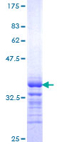 ab158799 on a 12.5% SDS-PAGE stained with Coomassie Blue.