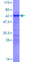 ab165718 on a 12.5% SDS-PAGE stained with Coomassie Blue.