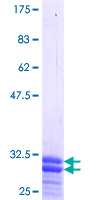 ab165719 on a 12.5% SDS-PAGE stained with Coomassie Blue.