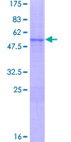 ab161944 on a 12.5% SDS-PAGE stained with Coomassie Blue.
