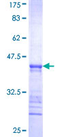 ab164600 on a 12.5% SDS-PAGE stained with Coomassie Blue.