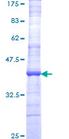 ab163571 on a 12.5% SDS-PAGE stained with Coomassie Blue.