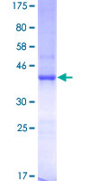 ab161437 on a 12.5% SDS-PAGE stained with Coomassie Blue.