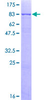 ab162638 on a 12.5% SDS-PAGE stained with Coomassie Blue.