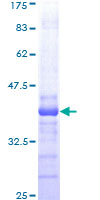 ab162639 on a 12.5% SDS-PAGE stained with Coomassie Blue.