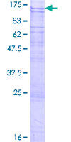 ab165907 on a 12.5% SDS-PAGE stained with Coomassie Blue.