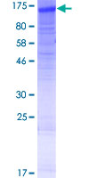 ab165246 on a 12.5% SDS-PAGE stained with Coomassie Blue.