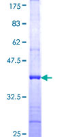 ab158584 on a 12.5% SDS-PAGE stained with Coomassie Blue.