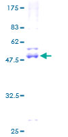 ab160872 on a 12.5% SDS-PAGE stained with Coomassie Blue.