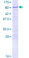 ab159004 on a 12.5% SDS-PAGE stained with Coomassie Blue.