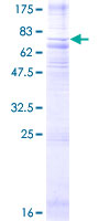 ab160942 on a 12.5% SDS-PAGE stained with Coomassie Blue.