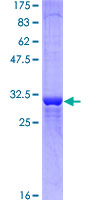 ab160943 on a 12.5% SDS-PAGE stained with Coomassie Blue.