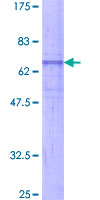 ab163433 on a 12.5% SDS-PAGE stained with Coomassie Blue.